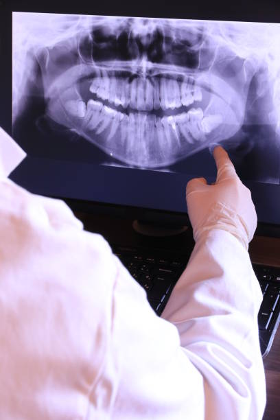 Best Emergency Dental Extractions in Woodville, OH