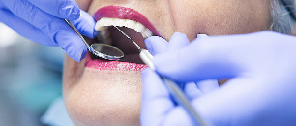 Best Emergency Dental Care for Abscessed Tooth in Woodville, OH